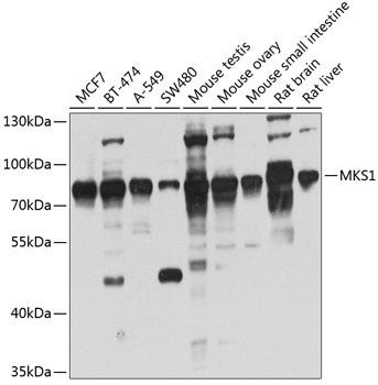MKS1 Rabbit pAb