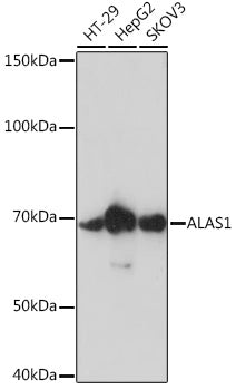 ALAS1 Rabbit mAb