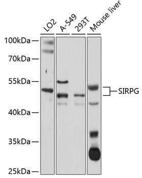 SIRPG Rabbit pAb