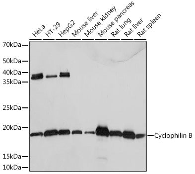 Cyclophilin B Rabbit mAb