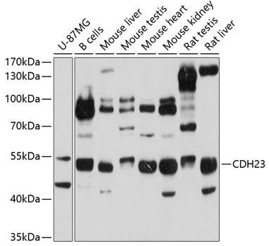 CDH23 Rabbit pAb