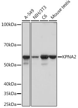 KPNA2 Rabbit mAb