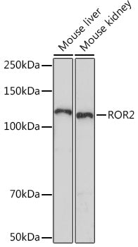 ROR2 Rabbit mAb