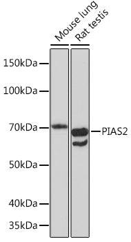 PIAS2 Rabbit mAb