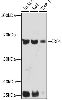 IRF4 Rabbit mAb