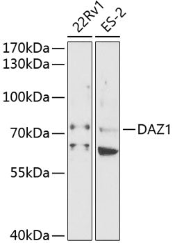 DAZ1 Rabbit pAb