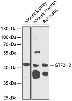 GTF2H2 Rabbit pAb