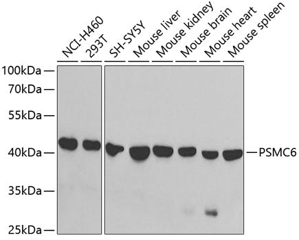 PSMC6 Rabbit pAb