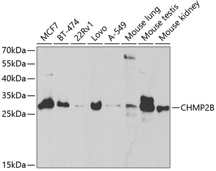 CHMP2B Rabbit pAb