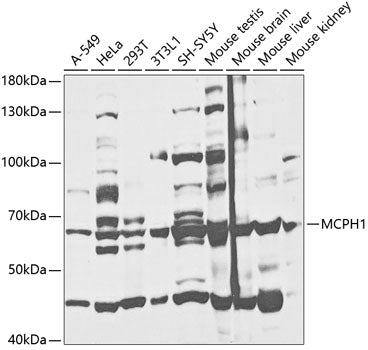 MCPH1 Rabbit pAb