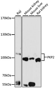 PKP2 Rabbit pAb