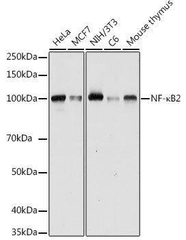 NF-κB2 Rabbit pAb