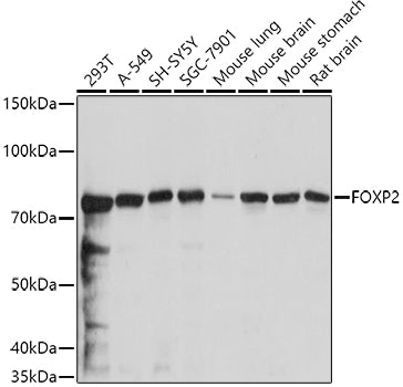 FOXP2 Rabbit pAb