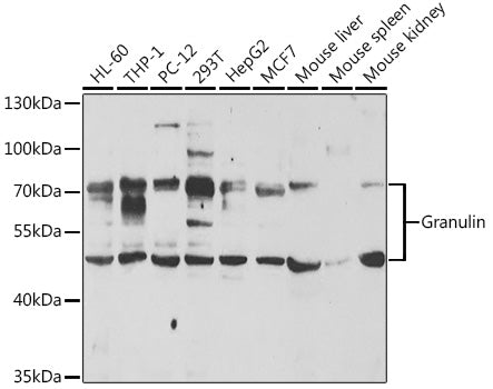 Granulin Rabbit pAb