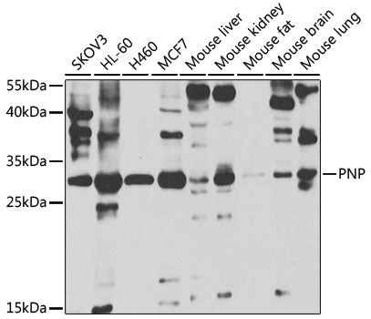 PNP Rabbit pAb
