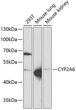CYP2A6 Rabbit pAb