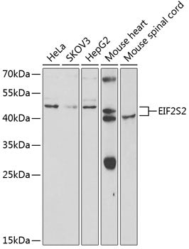 EIF2S2 Rabbit pAb
