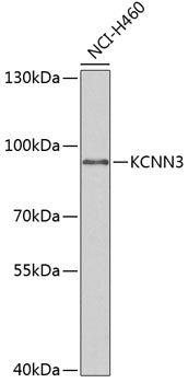KCNN3 Rabbit pAb