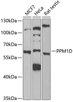 PPM1D Rabbit pAb