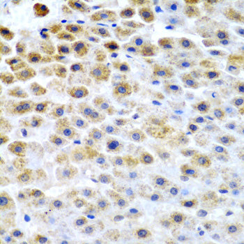 TFPI2 Rabbit pAb