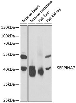 SERPINA7 Rabbit pAb