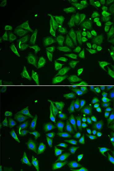 CLEC3B/Tetranectin Rabbit pAb