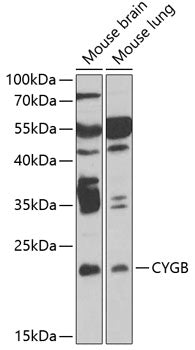 CYGB Rabbit pAb