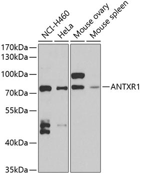 ANTXR1 Rabbit pAb