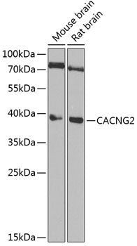 CACNG2 Rabbit pAb