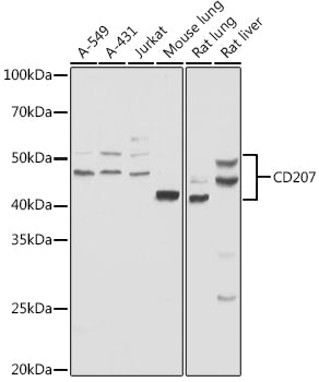 Langerin/CD207 Rabbit pAb