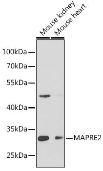MAPRE2 Rabbit pAb