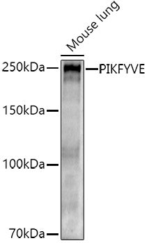PIKFYVE Rabbit pAb