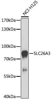 SLC26A3 Rabbit pAb
