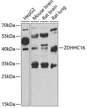 ZDHHC16 Rabbit pAb