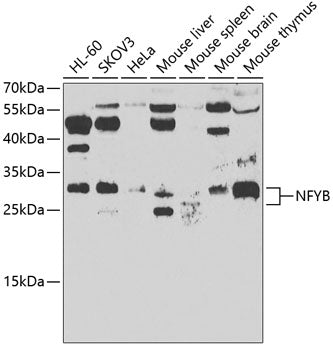 NFYB Rabbit pAb