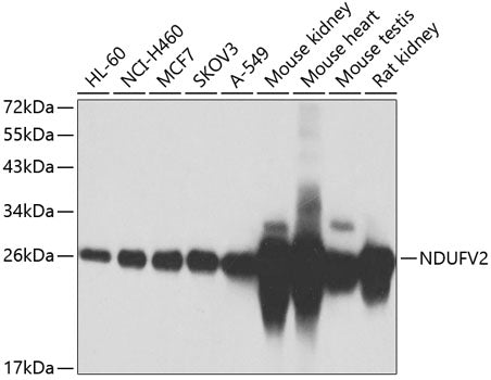 NDUFV2 Rabbit pAb