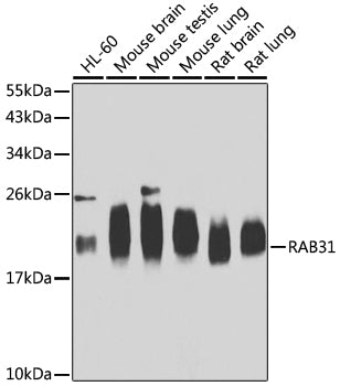RAB31 Rabbit pAb