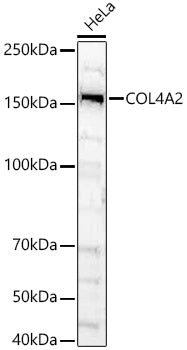 COL4A2 Rabbit pAb