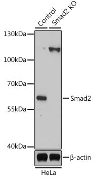[KO Validated] Smad2 Rabbit pAb