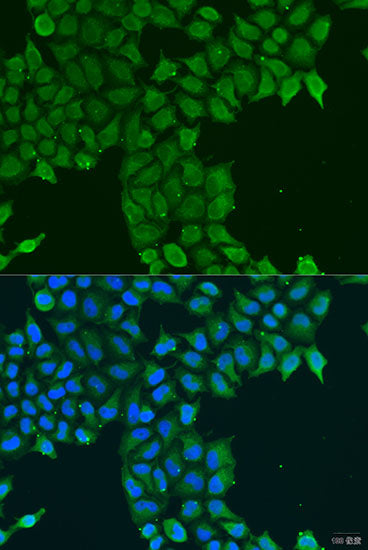 CDK16 Rabbit pAb