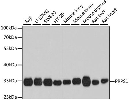 PRPS1 Rabbit pAb