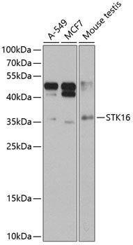 STK16 Rabbit pAb