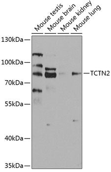 TCTN2 Rabbit pAb