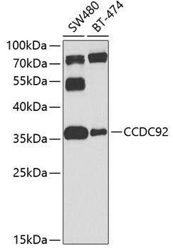 CCDC92 Rabbit pAb