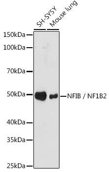 NFIB / NF1B2 Rabbit mAb
