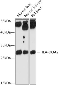 HLA-DQA2 Rabbit pAb