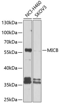 MICB Rabbit pAb