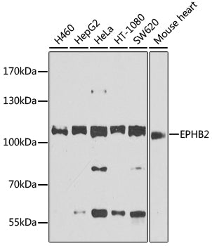 EPHB2 Rabbit pAb