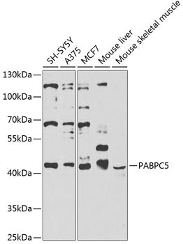 PABPC5 Rabbit pAb