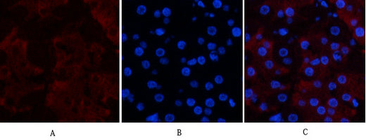 CD23 (3D1) Mouse Monoclonal Antibody